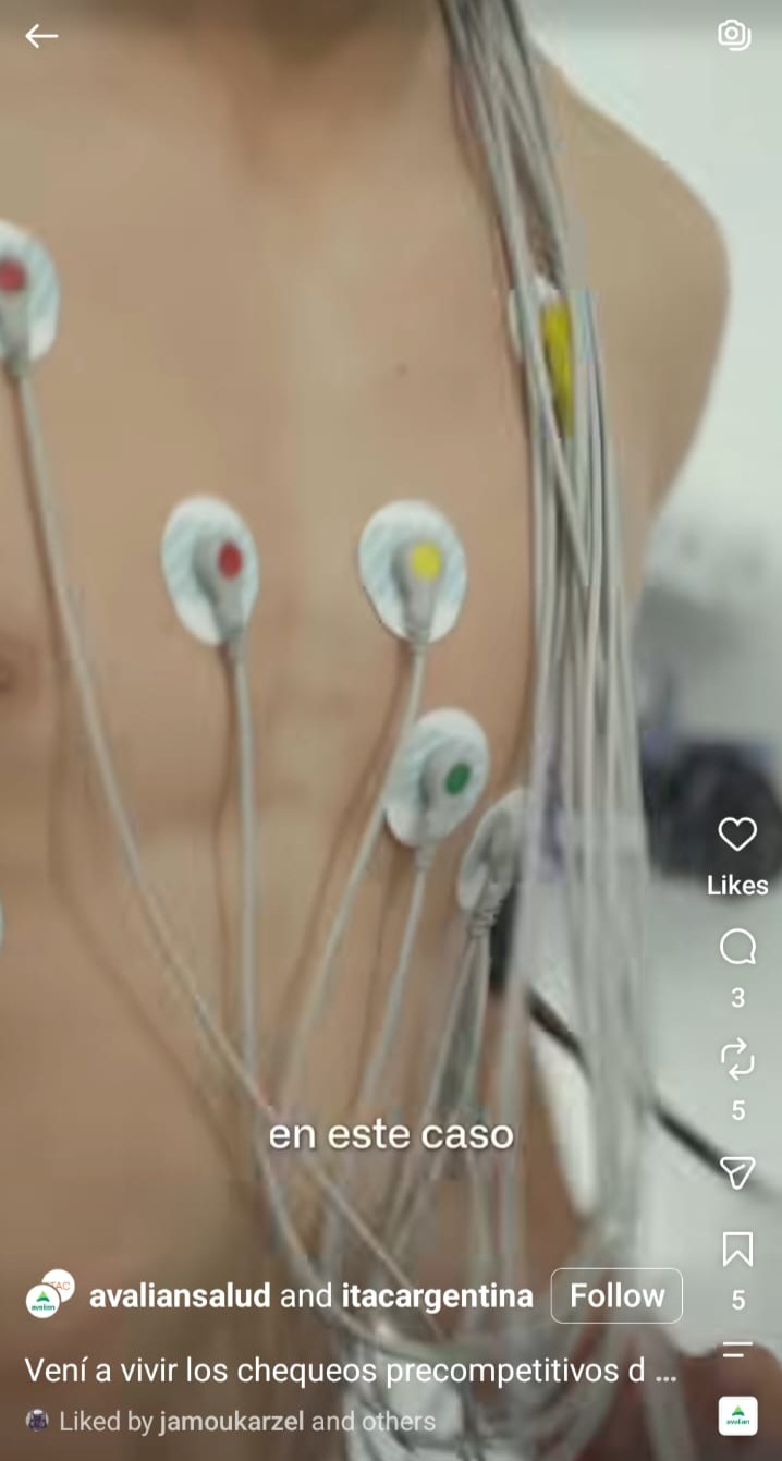 Electrocardiograma a jugador de River Plate